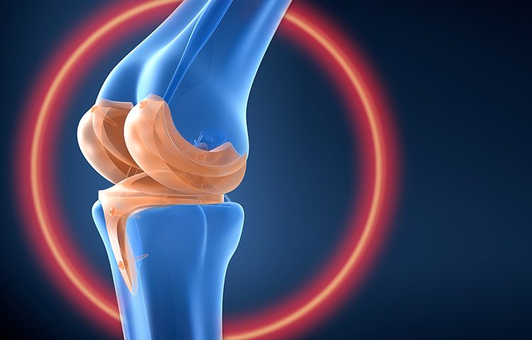 Knee Joint Replacement تعویض مفصل زانو